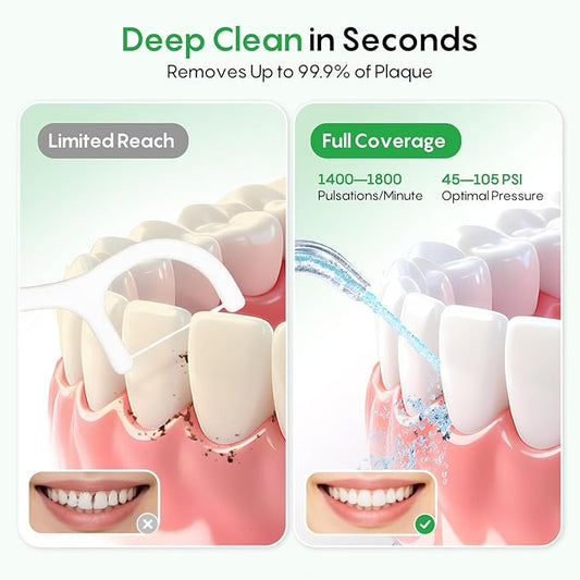 FRESKO Water Dental Flosser for Teeth, 300ML Flosser with Constant Pressure, Rechargeable Oral Irrigator Cleaner for Travel with 5 Jet Tips, IPX7 Waterproof