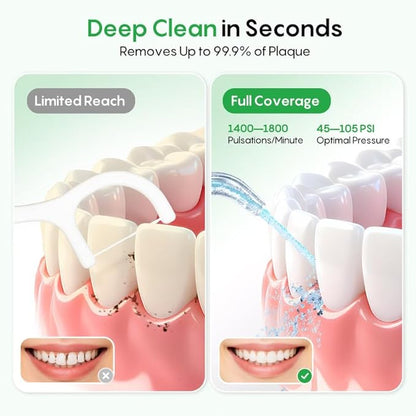 FRESKO Water Dental Flosser for Teeth, 300ML Cordless Flosser with Constant Pressure, Rechargeable Oral Irrigator Cleaner for Travel Home Use and Braces Care, IPX7 Waterproof, 5 Jet Tips