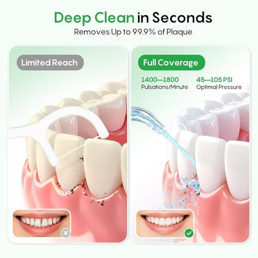 FRESKO Water Dental Flosser for Teeth, 300ML Cordless Flosser with Constant Pressure, Rechargeable Oral Irrigator Cleaner for Travel Home Use and Braces Care, IPX7 Waterproof, 5 Jet Tips