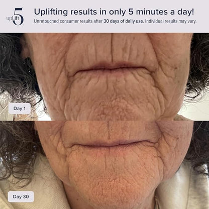 upLift 5 Pulsating Facial Lift | 5 Minute Age Reversal Device, Contours & Improves Facial Structures, Tightening & Toning of Skin