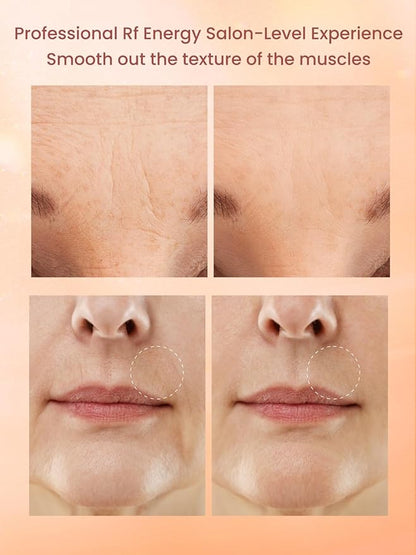 RF Radio Frequency Facial Device, 1MHz RF Machine for Anti-Aging & Face Lifting, Wireless Skin Tightening for Wrinkles & Jawline, 3 Modes for Home Use with Gel