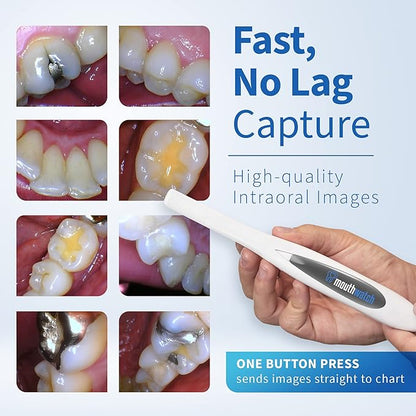 MouthWatch Intraoral Camera, Crystal Clear Images with an Easy to Use, Fast, Single Button Operation Dental Camera, Compatible with Over 50 Dental Imaging Suites, Lightweight and Ergonomic, 31 Grams