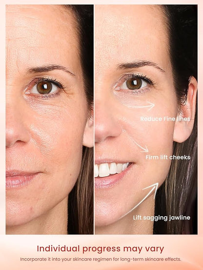 RF Radio Frequency Facial Device, 1MHz RF Machine for Anti-Aging & Face Lifting, Wireless Skin Tightening for Wrinkles & Jawline, 3 Modes for Home Use with Gel
