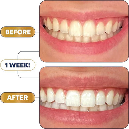 Lumineux Teeth Whitening Strips Kit - 9 Treatments (1 Month) - Peroxide Free - Enamel Safe for Whiter Teeth - Whitening Without The Sensitivity - Dentist Formulated - Sensitivity Free