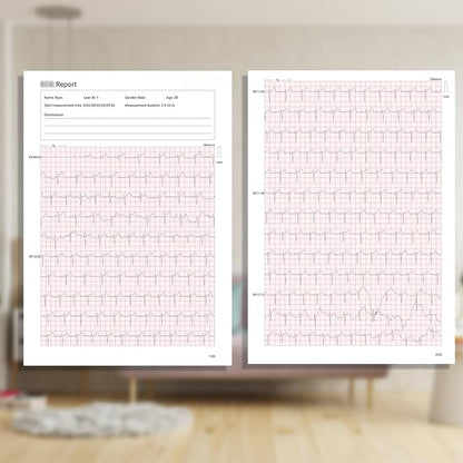 Livenpace 1-Lead Heart Health Monitor at Home, Portable 24 Hours Chest Lead Device with Free AI Analysis & PC Report, Rechargeable Recorder, HHM1