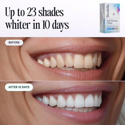 Boca Bella Teeth Whitening U-Wraps – 10 Treatments – 15% Hydrogen Peroxide, Enamel-Safe, No Harsh Sensitivity – Patented Strip Design with Aloe, Calendula & Peppermint – Fast, Even Whitening