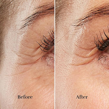 Silk’n Anti-Aging Device - Titan Mini - Wrinkle Reduction and Skin Tightening - Rejuvenates Skin on Smaller Face Areas - Cordless Use - Skin Care Device with LED - Unisex Hygiene and Personal Care