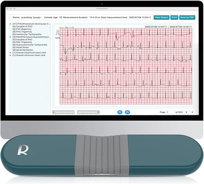 Livenpace 1-Lead Heart Health Monitor at Home, Portable 24 Hours Chest Lead Device with Free AI Analysis & PC Report, Rechargeable Recorder, HHM1